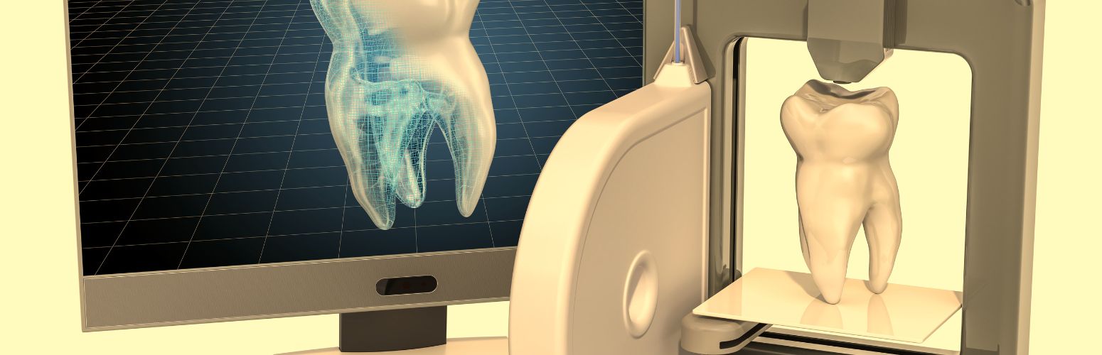 3D printing of a tooth