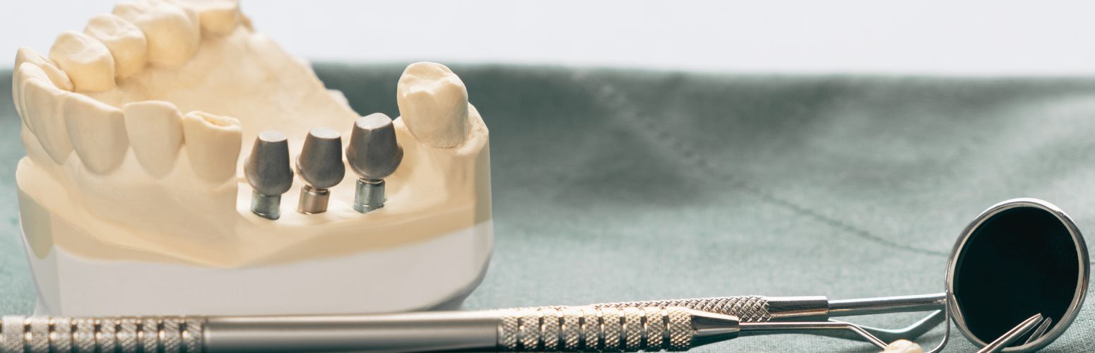 denture or implant