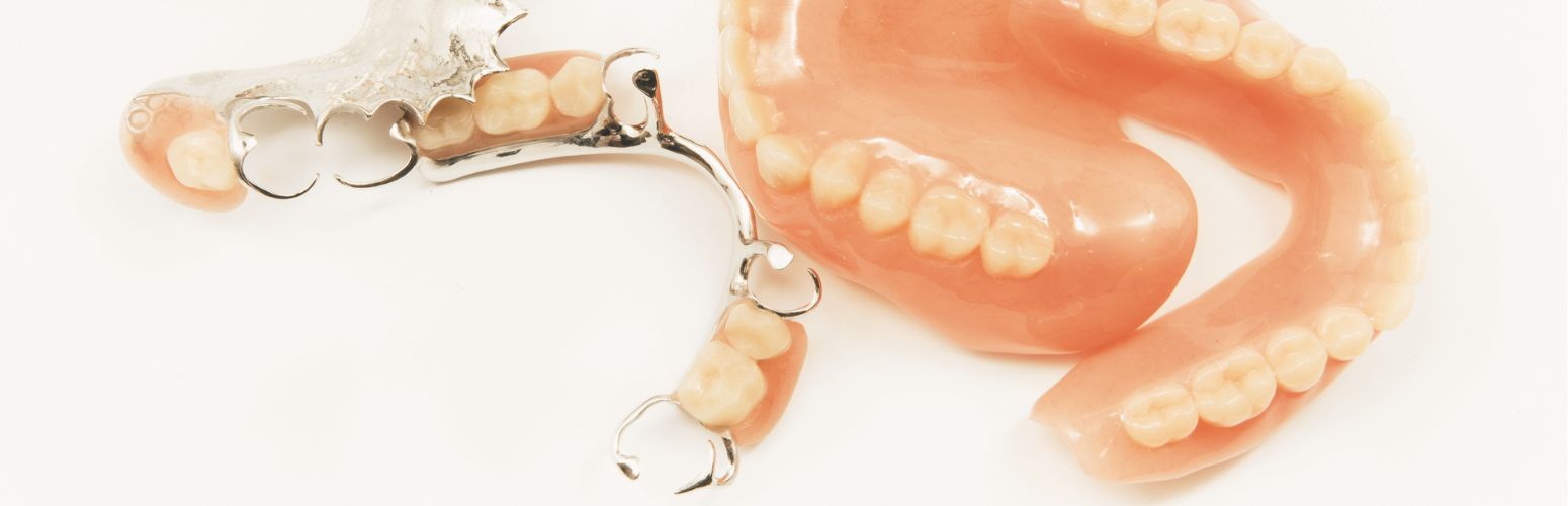 partial denture for a few missing teeth vs full denture for many missing teeth