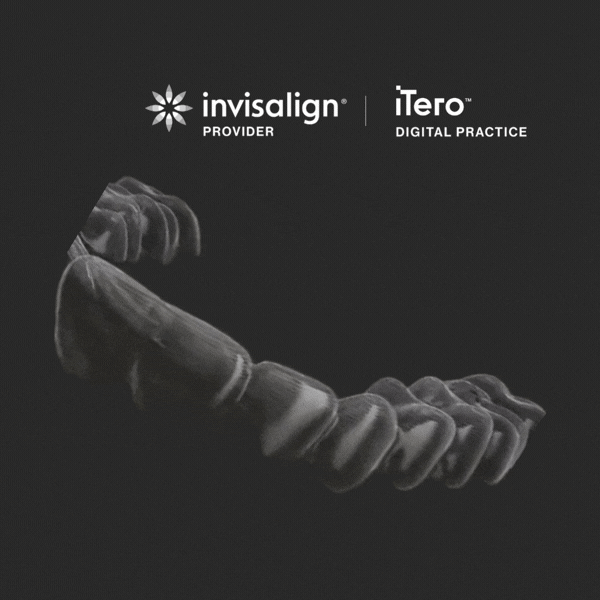 iTero Lumina Pro 3D scan for Invisalign at Dentalis Singapore