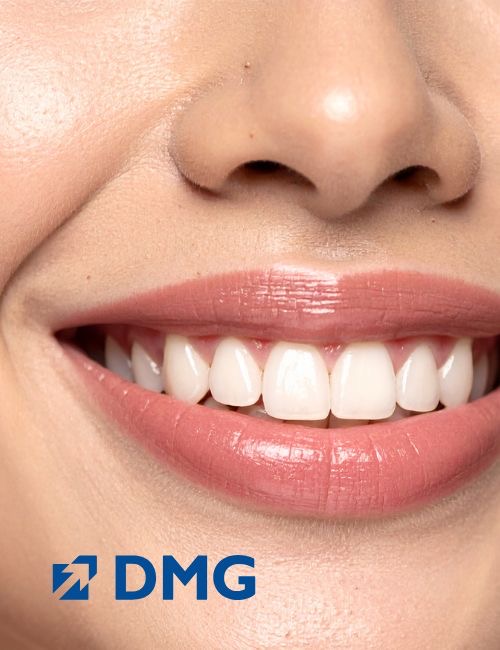 How to remove white spots on teeth caused by braces