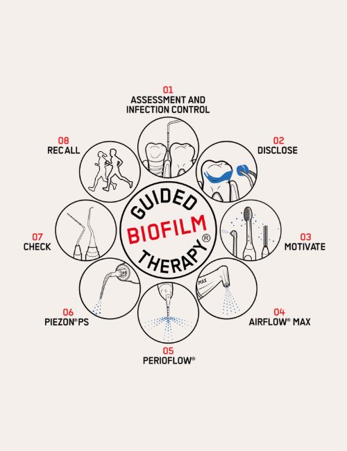 The 8-step GBT protocol at Dentalis Singapore — Guided Biofilm Therapy